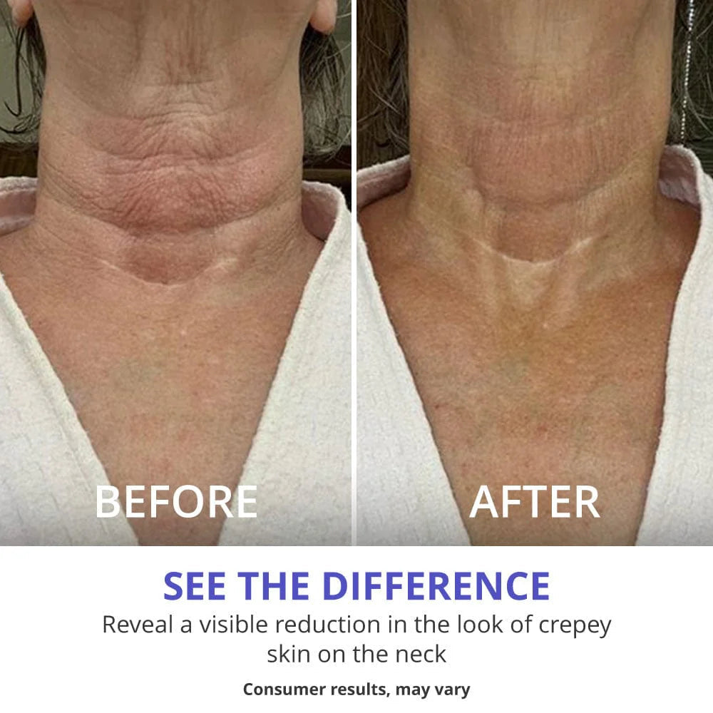 Neklift™Crème - Pure Versteviging en Lift