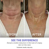 Neklift™Crème - Pure Versteviging en Lift