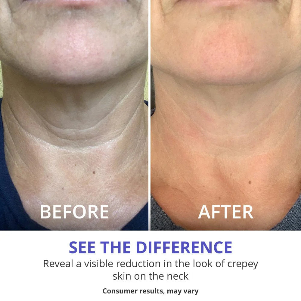 Neklift™Crème - Pure Versteviging en Lift