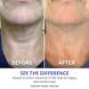 Neklift™Crème - Pure Versteviging en Lift