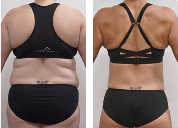 PerfectWave™ Body Sculptor