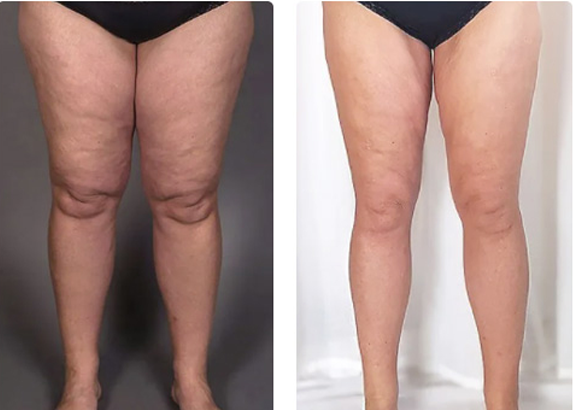 PerfectWave™ Body Sculptor