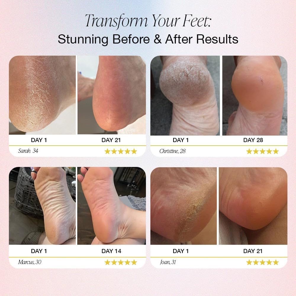 SmoothStep™ Pro